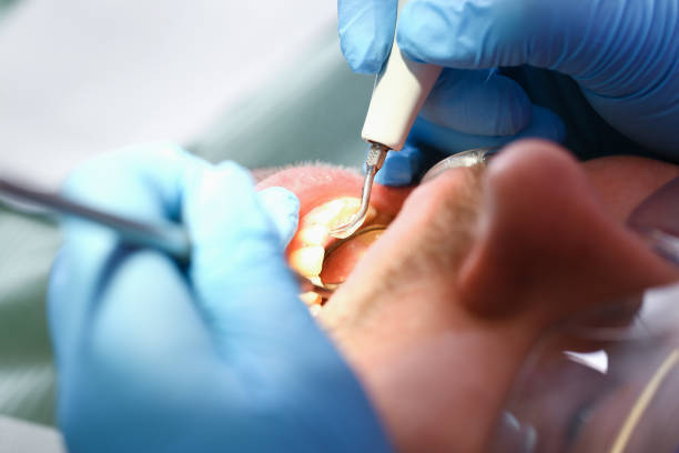 Best Weekend Emergency Dentist in Von Ormy, TX